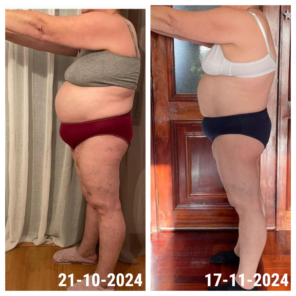 Resultado antes e depois de uma aluna INSHAPE