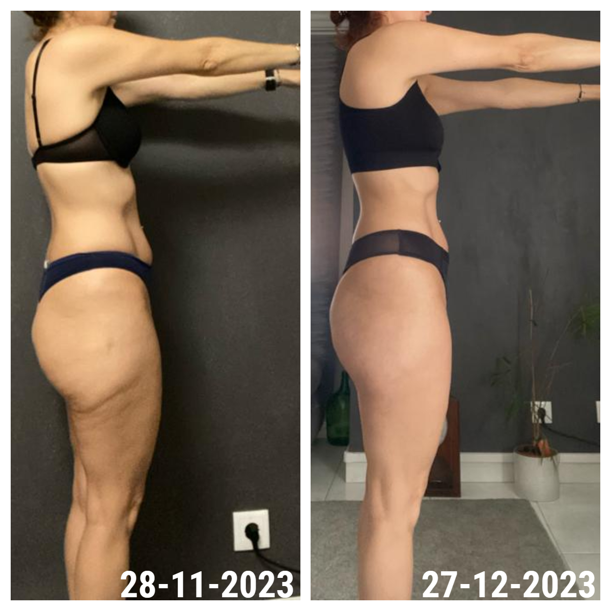 Resultado antes e depois de uma aluna INSHAPE